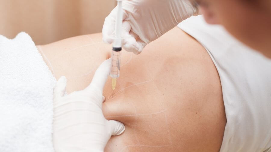 A patient undergoing mesotherapy