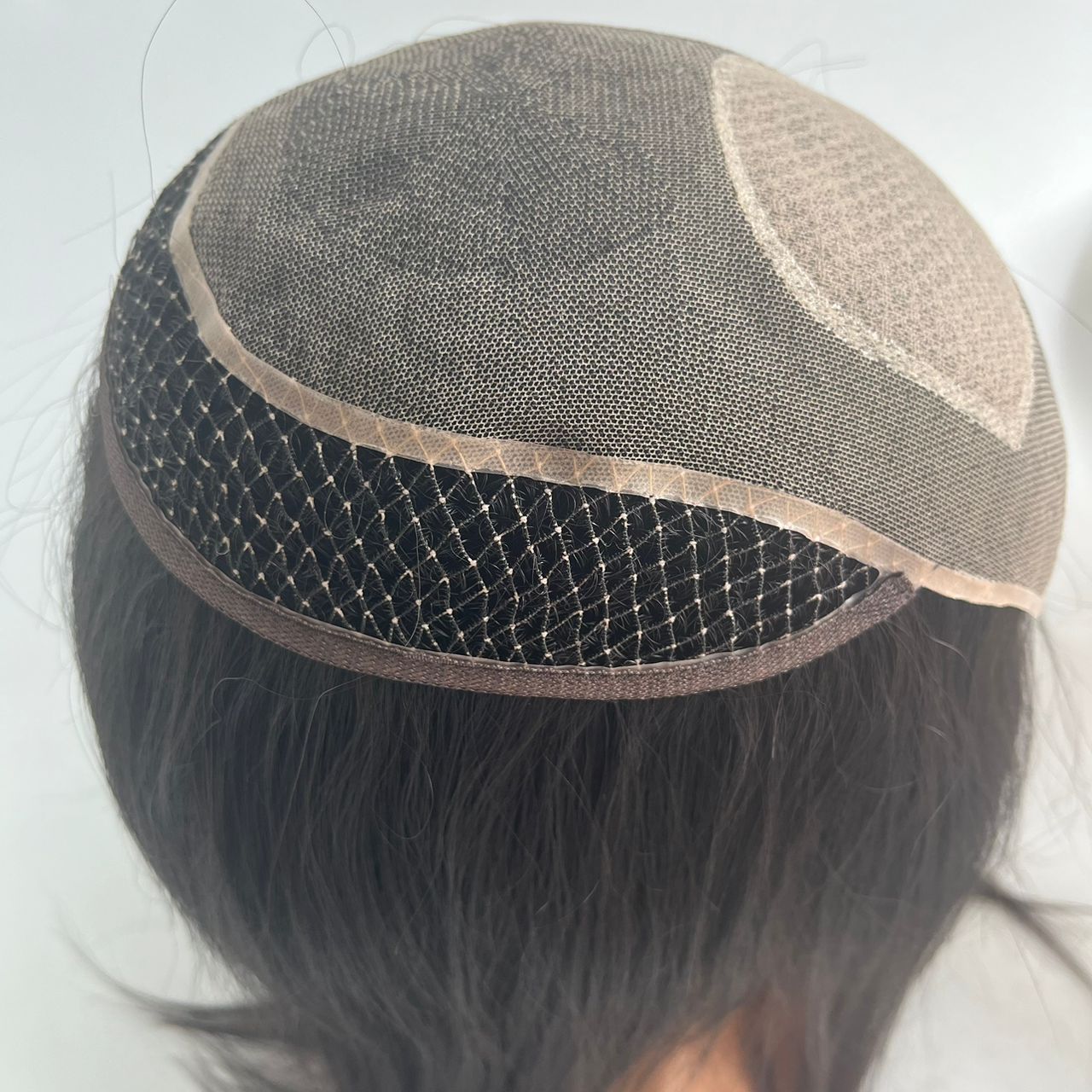 Grand Prize at Alopecia and Trichotillomania event