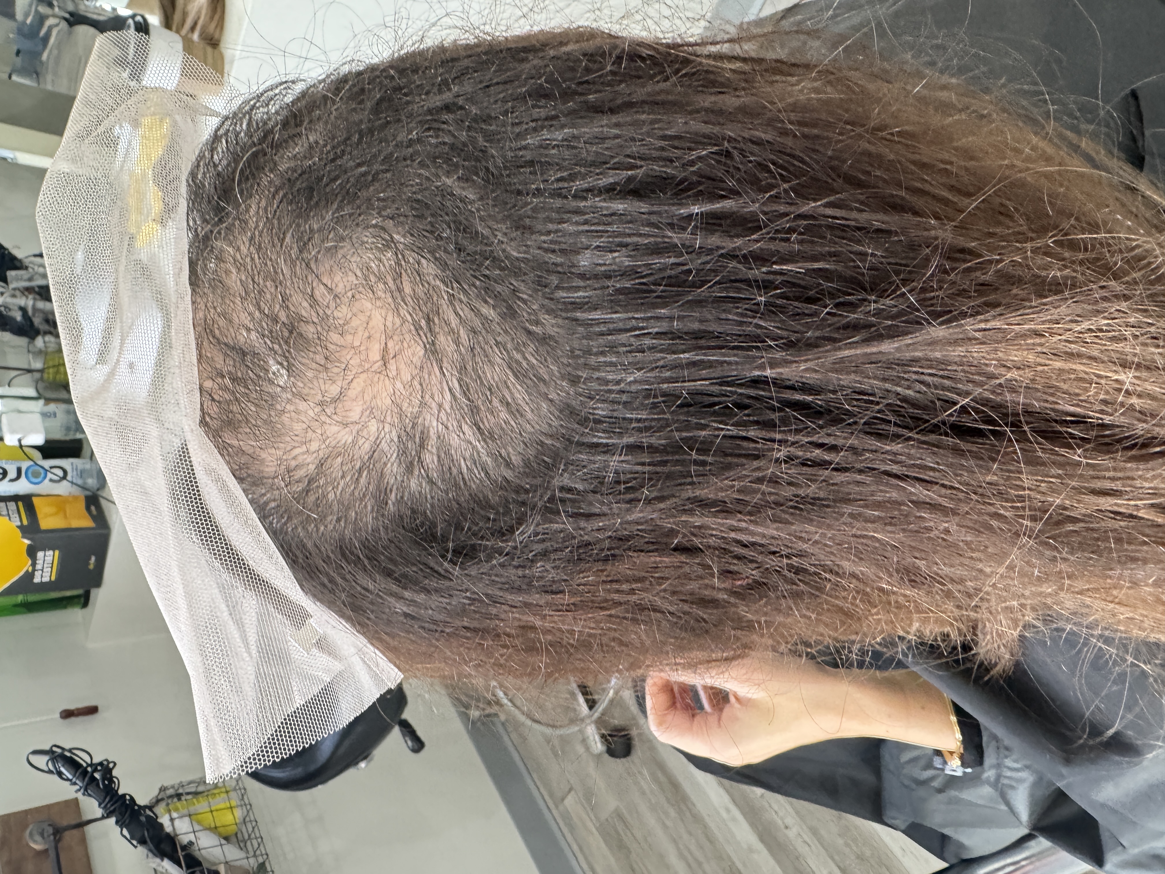 a picture of a person with crinkly hair strands due to hair pulling
