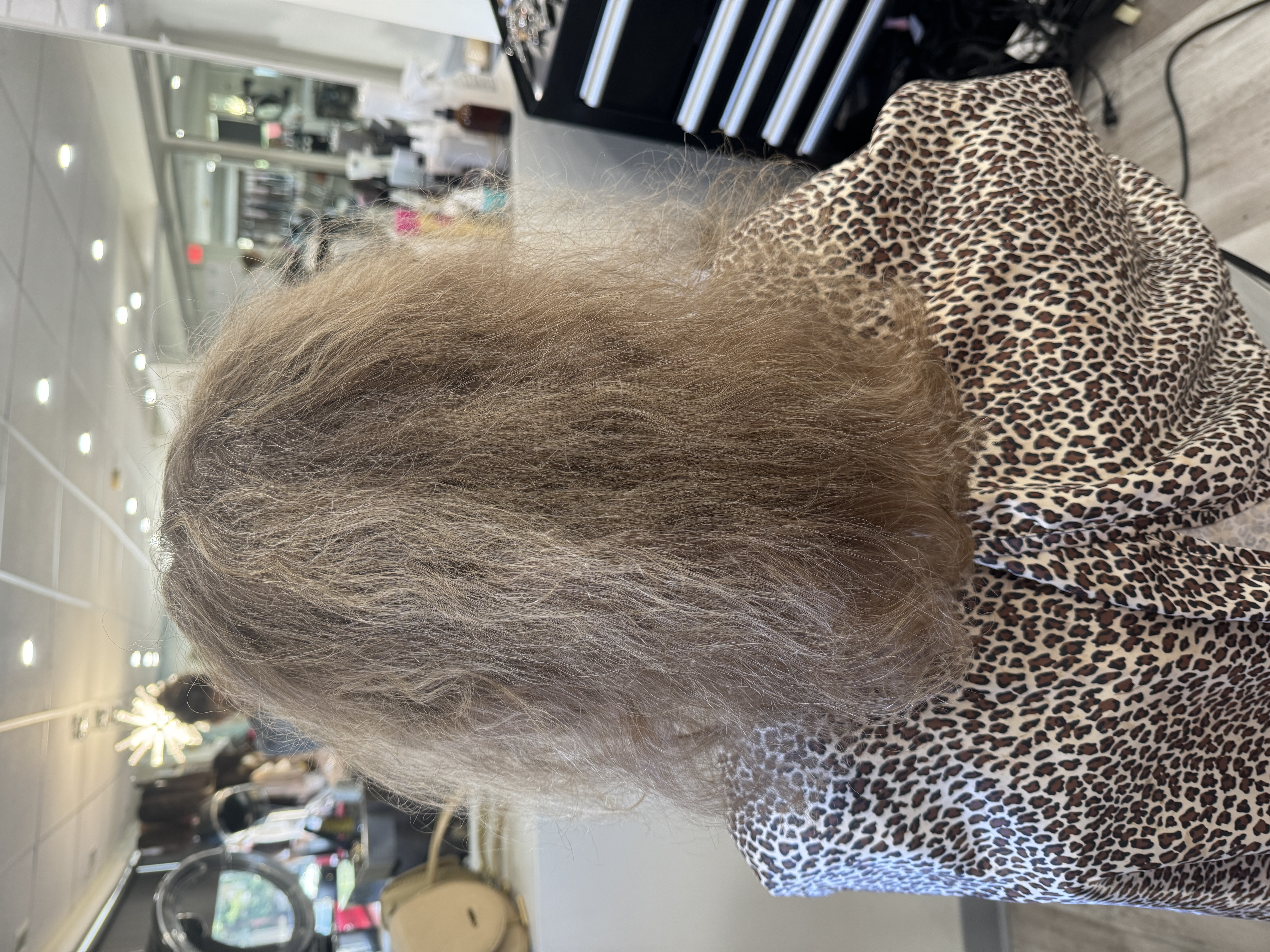 hair shedding from postpartum hair loss