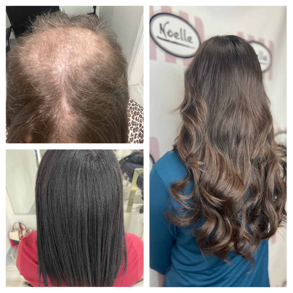 Perfect Partial Wig Application Unveiling the Secrets Boston Massach noellesalon