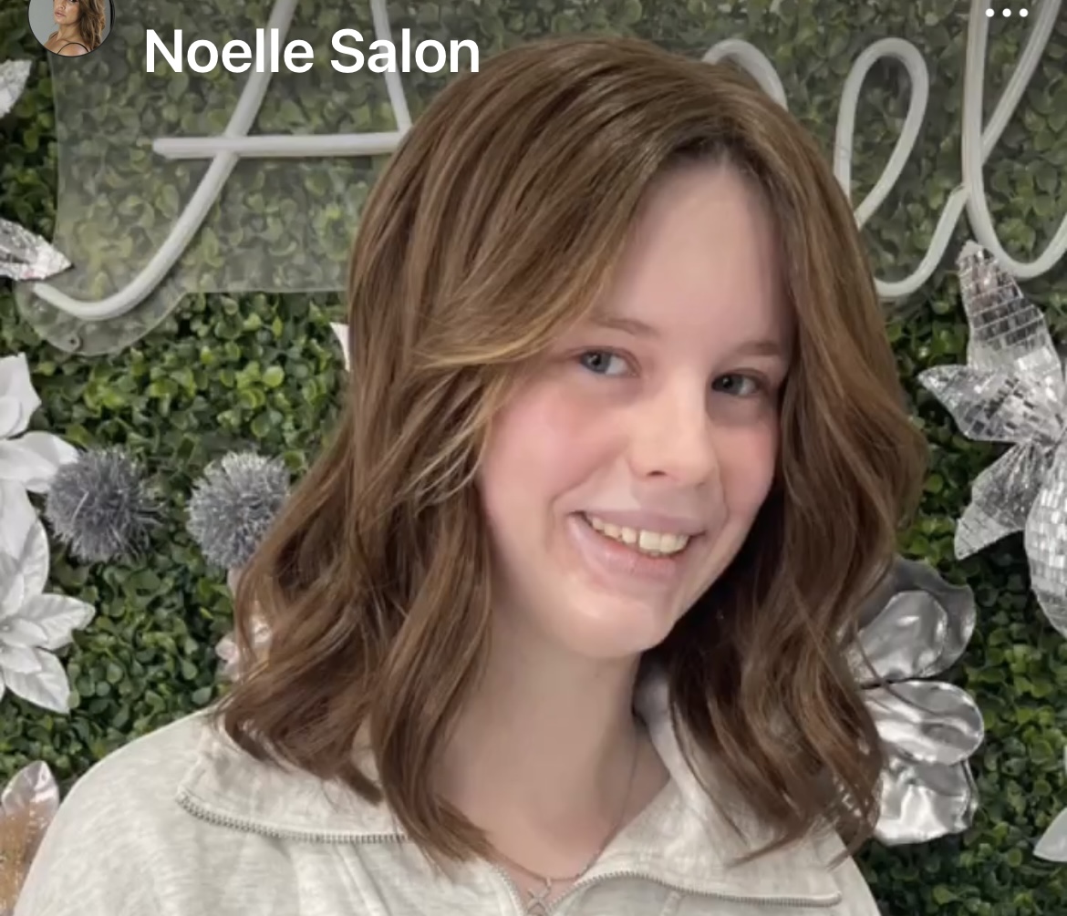 an after picture of a woman wearing a hair topper to create a trichotillomania barrier