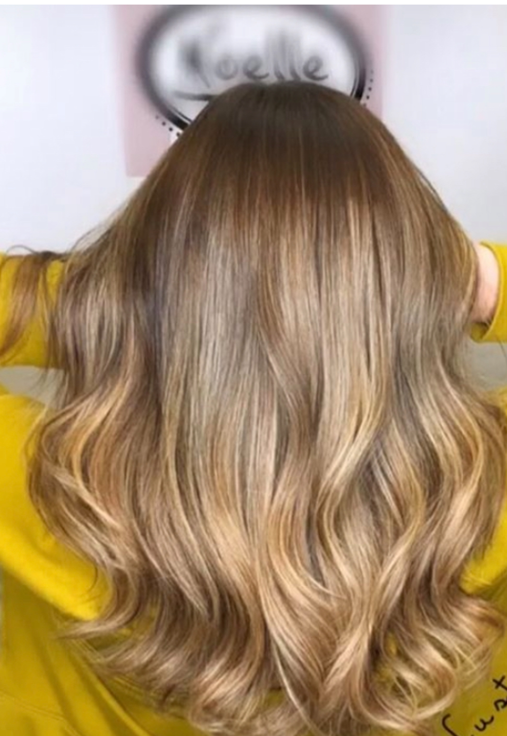 A woman wearing mesh integration to cover hair pulling disorder