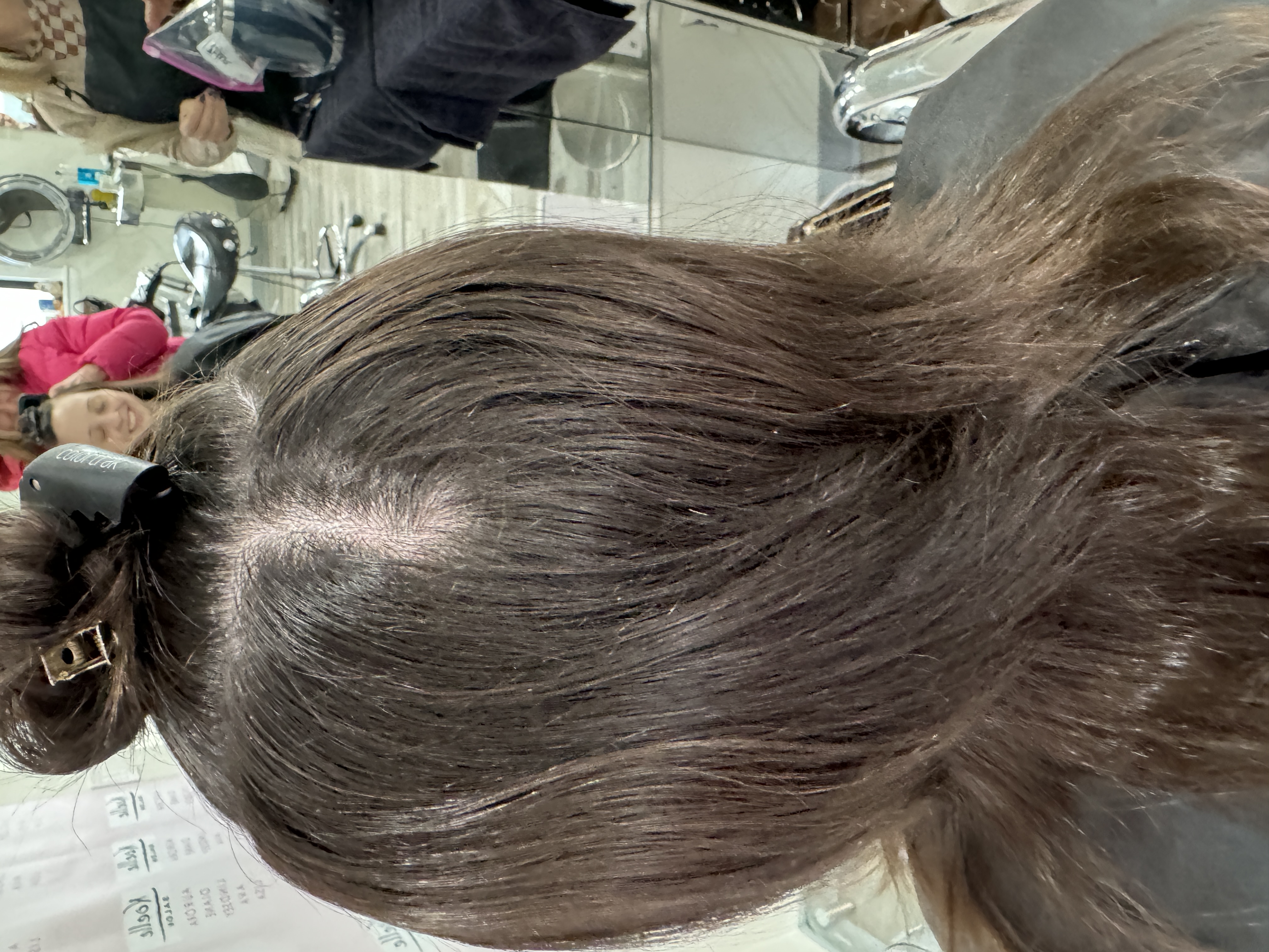 Thinning hair due to weight loss from Trizepatide