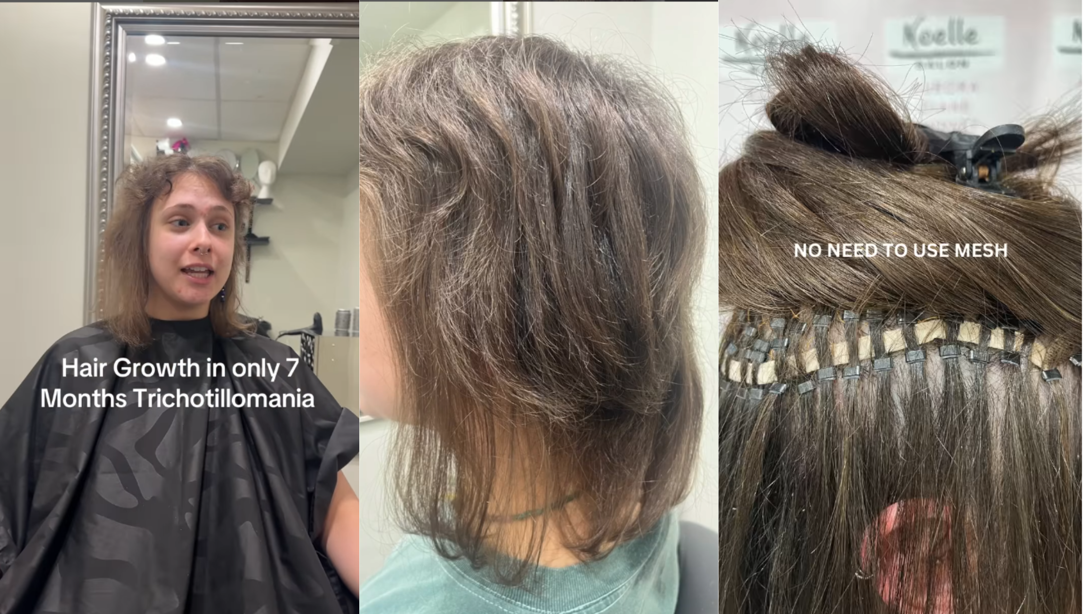 Illustration of clients with hair concern