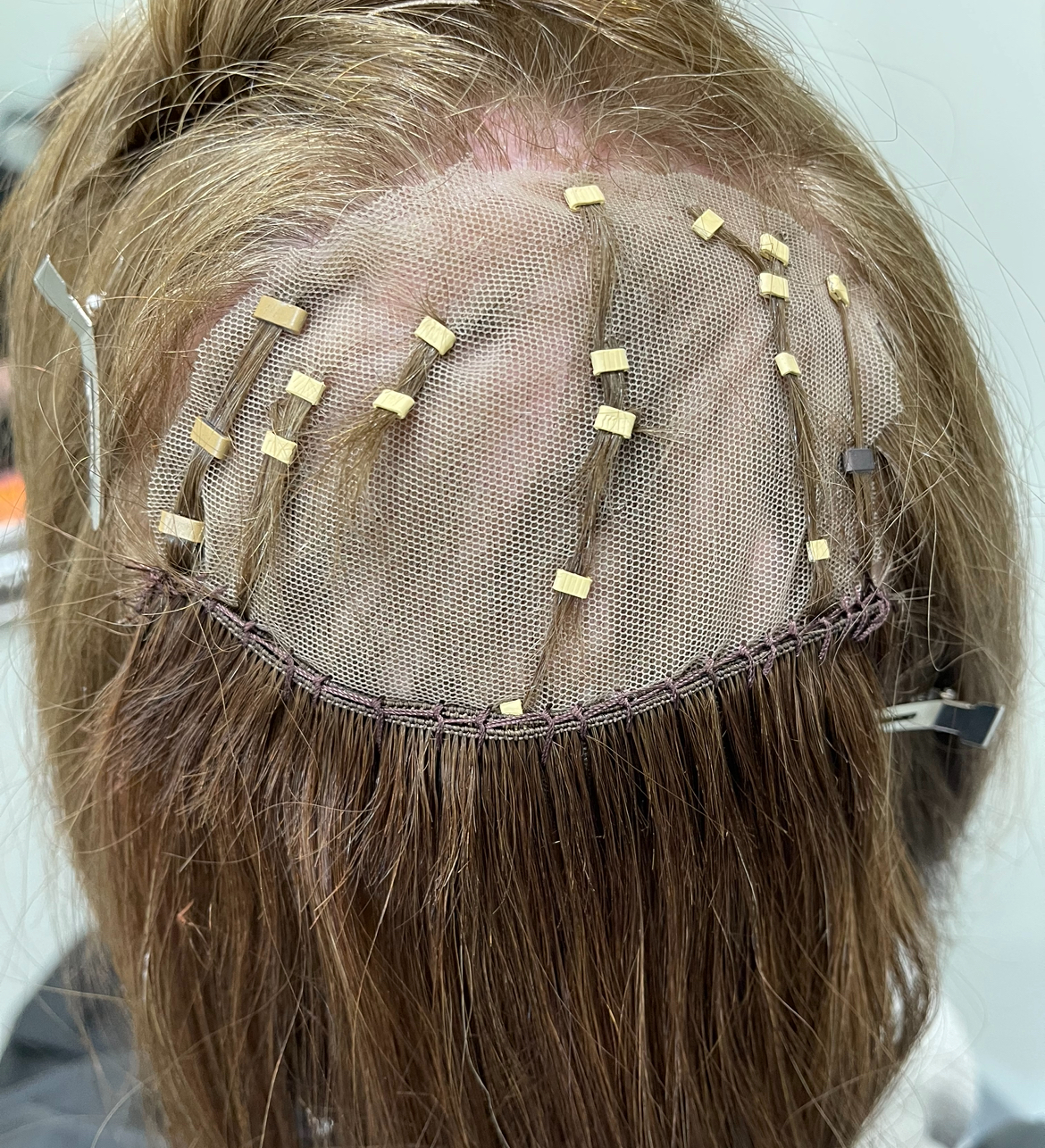 mesh integration hair loss system