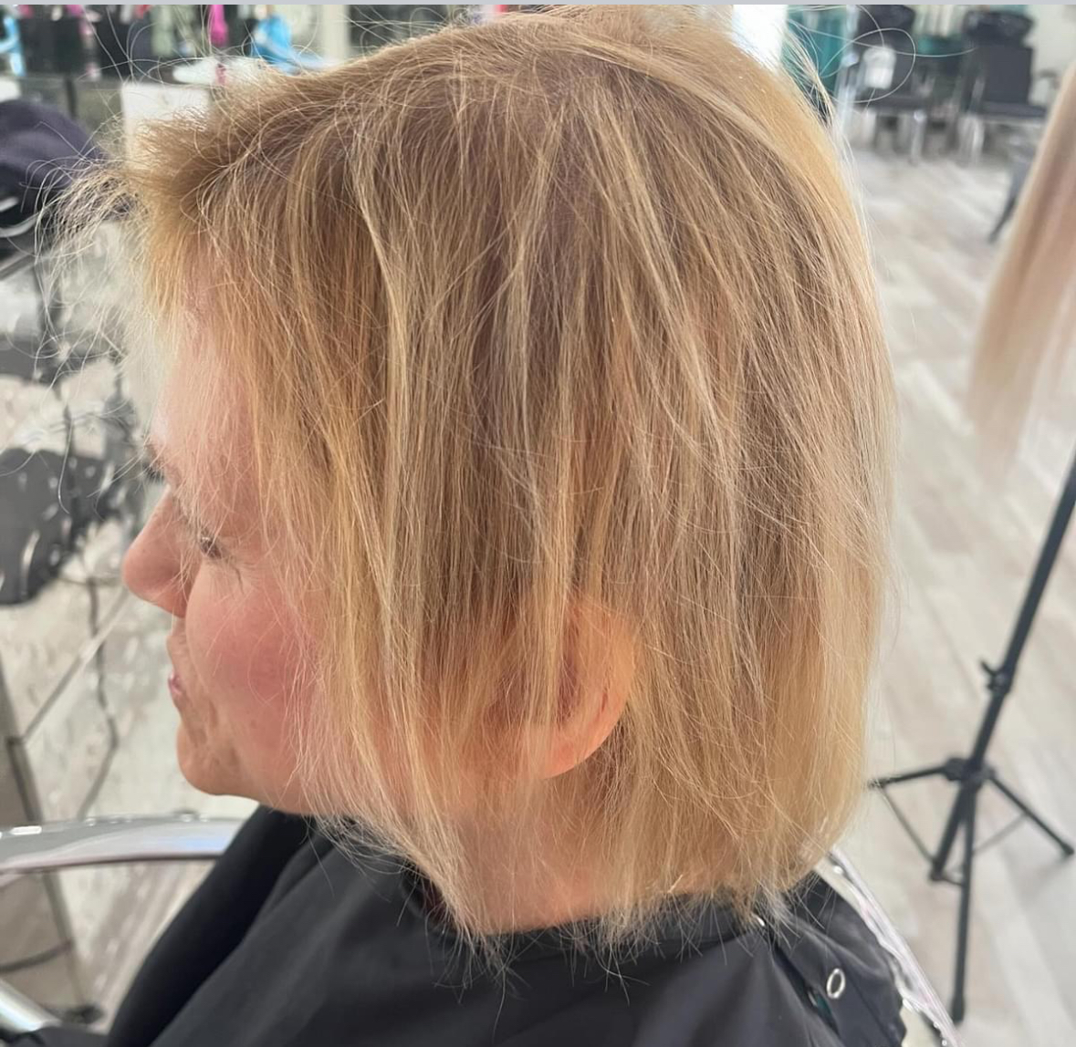 androgenetic alopecia causes hair to fall out
