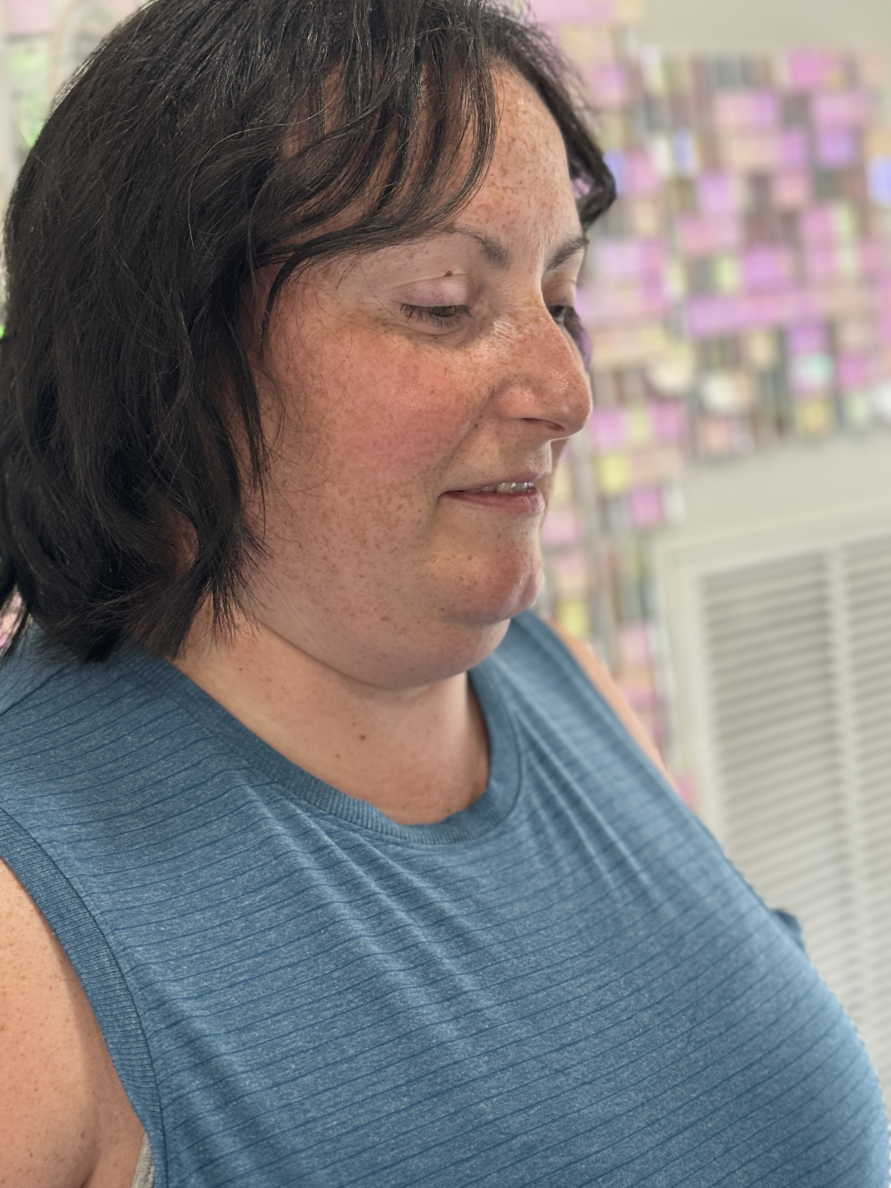 a woman with chemotherapy induced hair loss