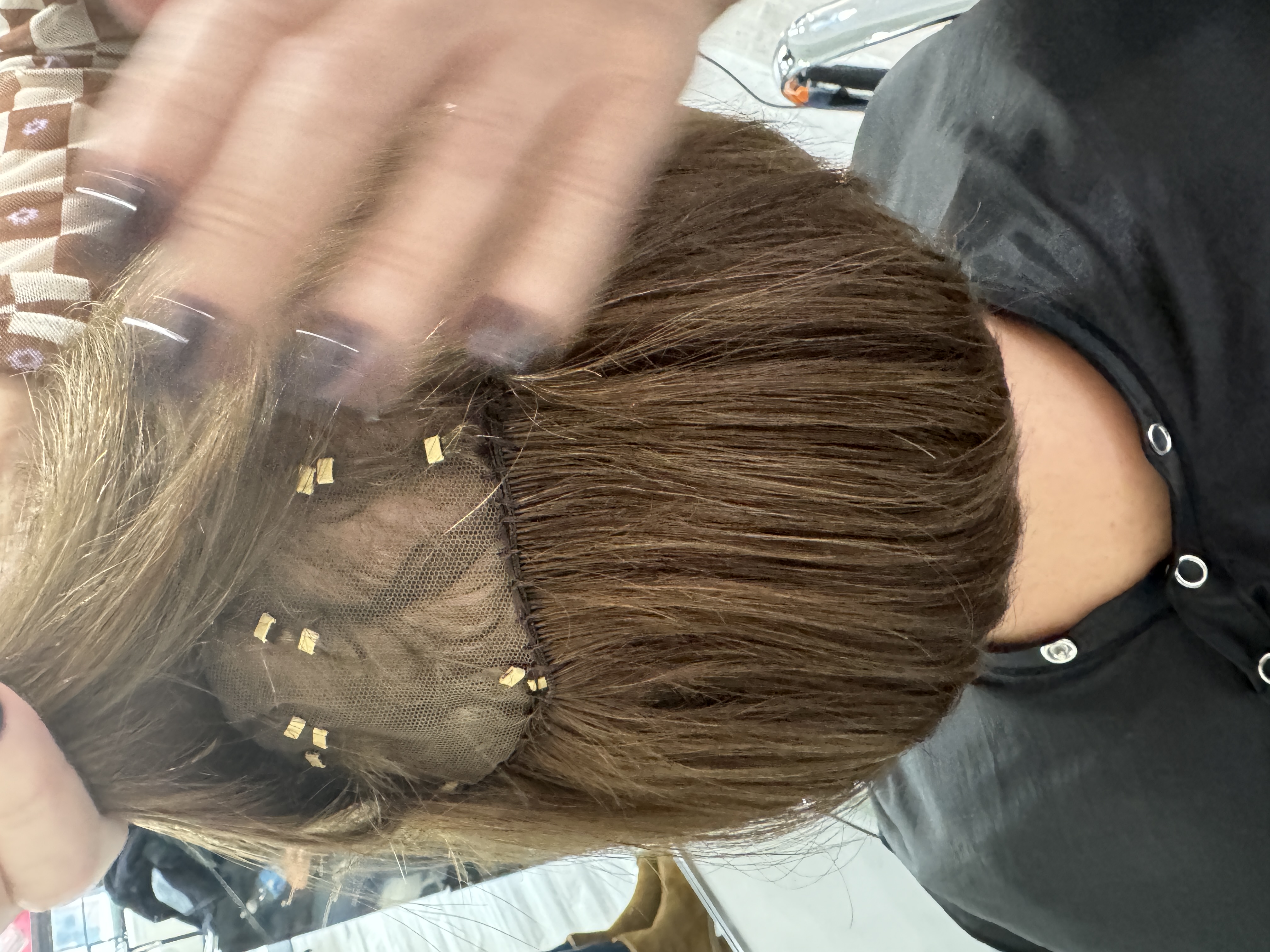 a mesh integration hair system helps with trichotillomania