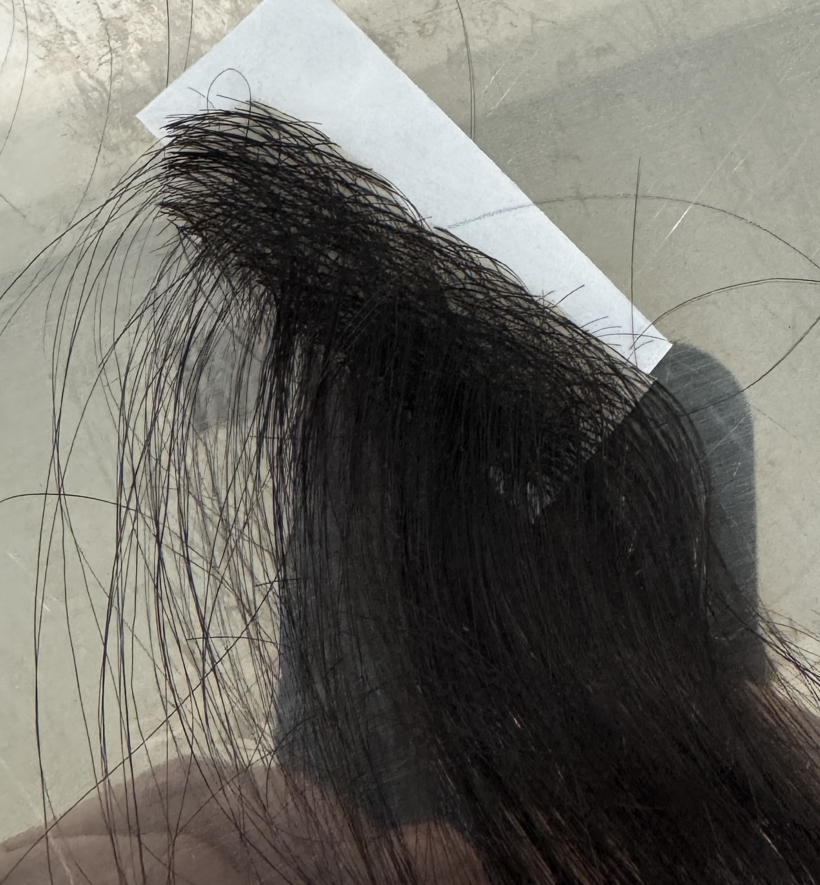 close up picture of a hair patch for boys with trichotillomania