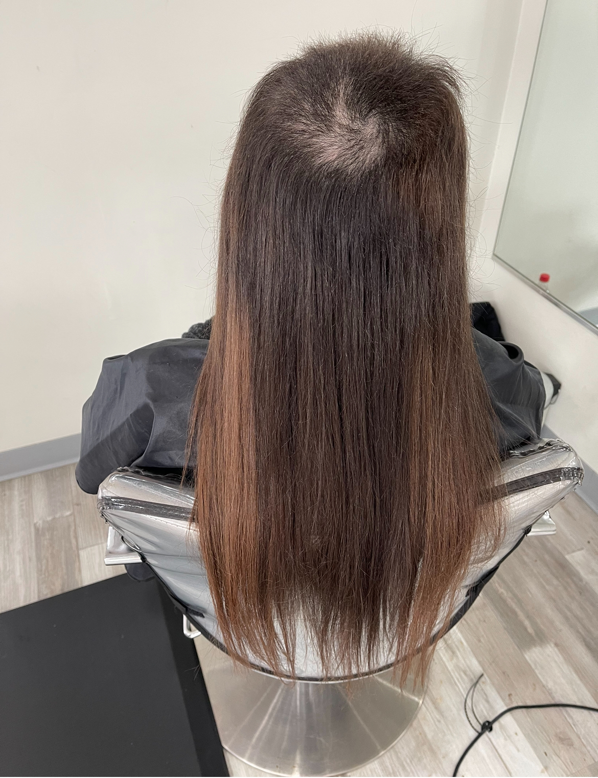 a person growing their hair back from ttm