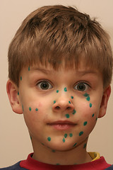 Image showing Boy with Green Dots