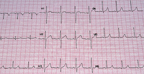 Image showing Electrocardiogram.