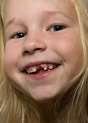 Image showing funny toothless smile