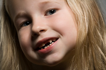 Image showing little girl without a front tooth