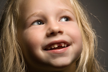 Image showing little girl without one front tooth