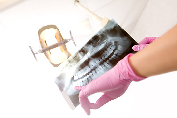 Image showing Dentist X-ray Detail
