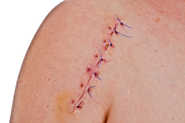 Image showing Scar