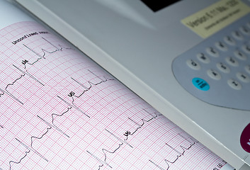 Image showing Electrocardiogram.