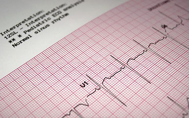 Image showing Pediatric electrocardiogram.