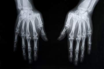 Image showing x-ray picture of human hands