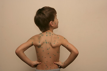 Image showing Boy with Green Dots
