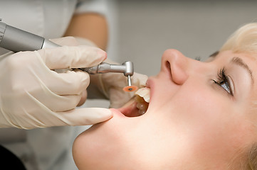 Image showing dentist care work