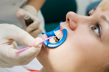 Image showing dental procedure of teeth protecting