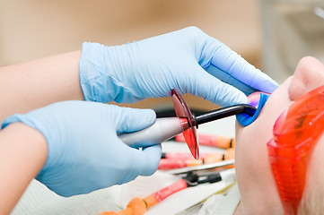 Image showing dentist ultraviolet light equipment