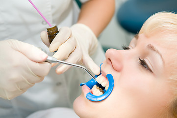 Image showing dental teeth treatment