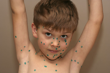 Image showing Boy with Green Dots