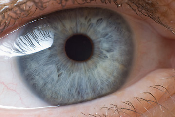 Image showing Eye