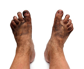 Image showing dirty unhygienic foots