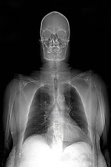 Image showing This is a real MRI (Magnetic Resonance Image) of a man, showing the head, shoulders, lungs,thoracic cavity, arms, and heart.