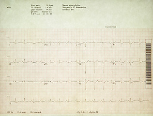 Image showing A real 12 Lead EKG.