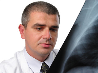 Image showing Doctor analyzing a chest radiography