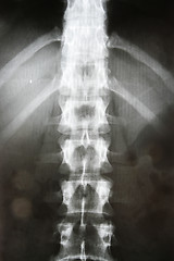 Image showing X-ray