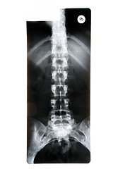 Image showing X-ray