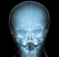 Image showing Skull of a normal child