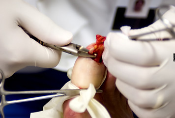 Image showing Podiatric Surgery 1