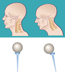 Image showing Neck spine