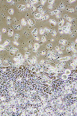 Image showing Colon Cancer cells