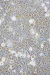 Image showing Colon Cancer cells