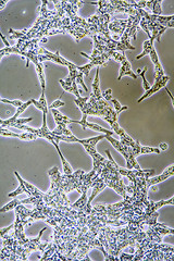 Image showing Prostate Cancer cells