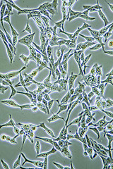 Image showing Prostate Cancer cells