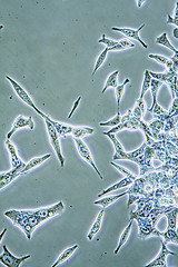 Image showing Prostate Cancer cells