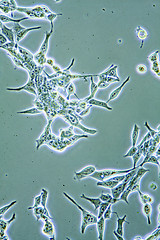 Image showing Prostate Cancer cells