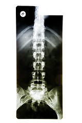 Image showing X-ray