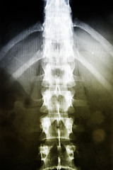 Image showing X-ray