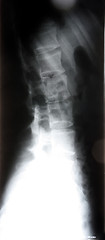 Image showing X-ray